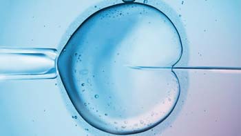 Intracytoplasmic Sperm Injection (ICSI) in Iran