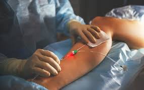 Iran's Premier Peripheral Vascular Surgery: Advanced Limb-Saving Care at Low Costs