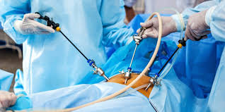 Advanced Laparoscopic Surgery in Iran: Precision Care at Affordable Costs