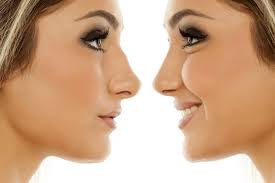 Nose Fillers in Iran: Affordable Non-Surgical Reshaping