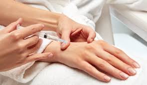 Back of Hand Filler Injections in Iran: Affordable Hand Rejuvenation