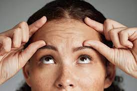 Botox for Forehead Lines in Iran: Smooth Skin Awaits