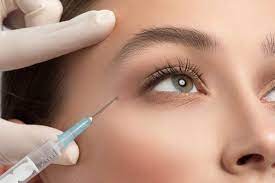 Crow’s Feet Botox in Iran: Refresh Your Eyes