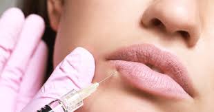 Lip Flip Botox Injection in Iran