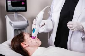 Rejuvenate with Thermage Skin Tightening in Iran