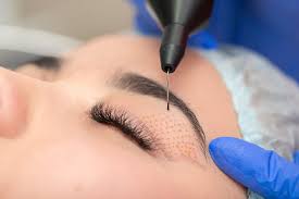 Transform Skin with Plasma Pen Plexr in Iran