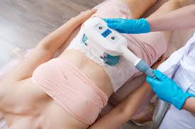 Sculpt Your Body with Cryolipolysis in Iran
