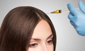 Thicken Hair: PRP Hair in Iran
