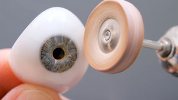 Restore Your Appearance with Prosthetic Eye Surgery in Iran
