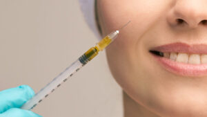 Glow Skin: Facial PRP in Iran