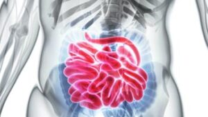 Comprehensive Guide to Small Bowel Surgery in Iran: Restoring Digestive Health