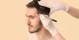 زراعة الشعر في مشهد