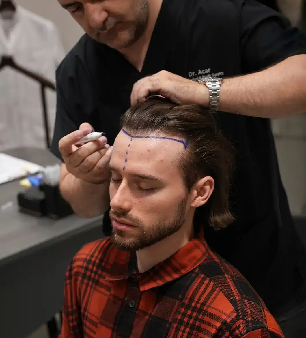 Dr. Levent Acar marking a patient's hairline before surgery at Cosmedica Clinic, Istanbul (official clinic photo).