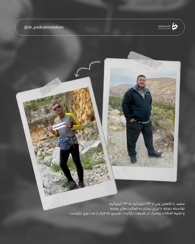 Provider-published weight-loss before and after example 15 from Dr Pedram Talebian