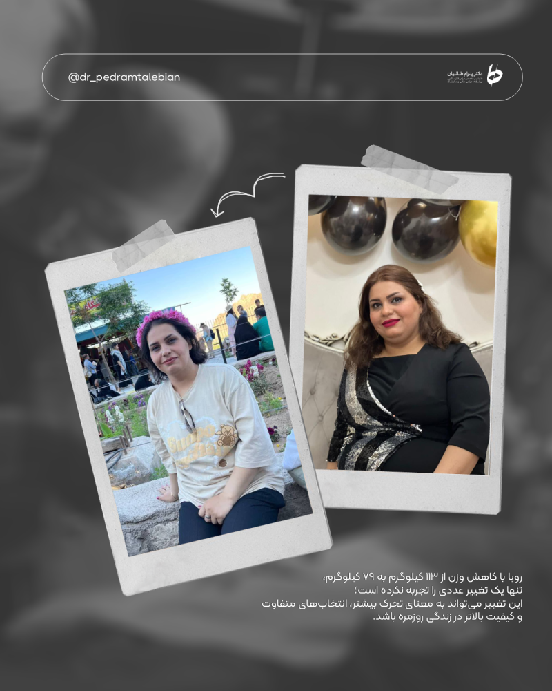 Provider-published weight-loss before and after example 16 from Dr Pedram Talebian