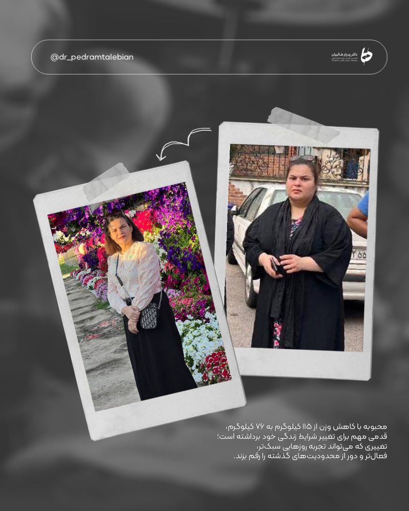 Provider-published weight-loss before and after example 18 from Dr Pedram Talebian