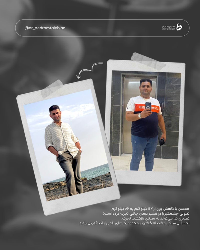 Provider-published weight-loss before and after example 19 from Dr Pedram Talebian