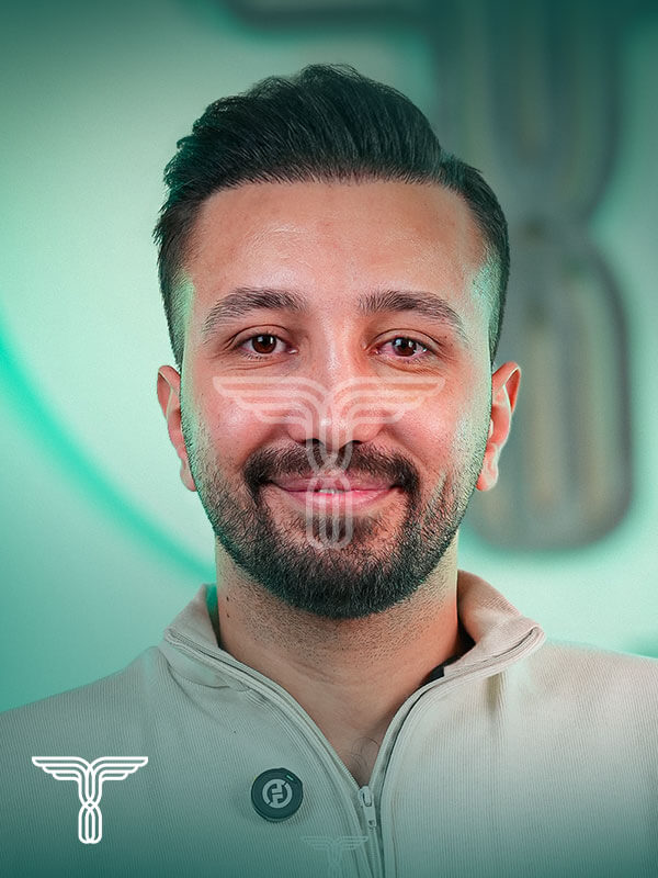 Scalp transplant after photograph, case TK-1, source: Tehran Kasht