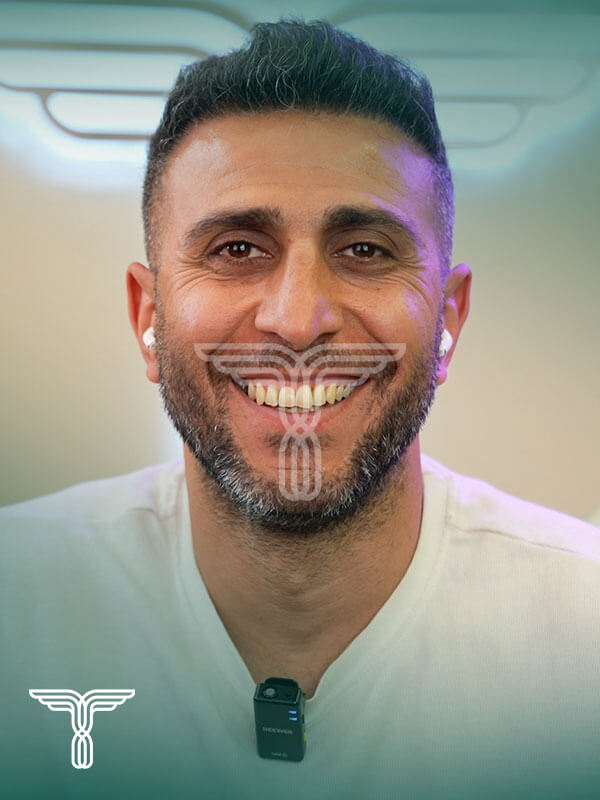Scalp transplant after photograph, case TK-5, source: Tehran Kasht