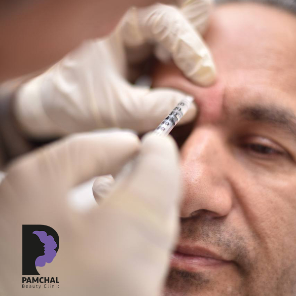 Botulinum toxin results before and after example 3 in Tehran