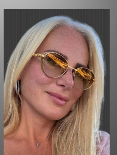 Umut Zereyak facelift case 3, after photograph from the credited source gallery