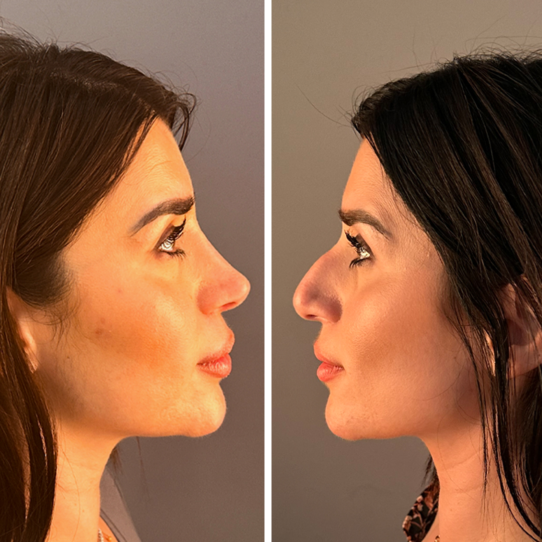 Provider-published before-and-after comparison, Mithat Topal, image 1
