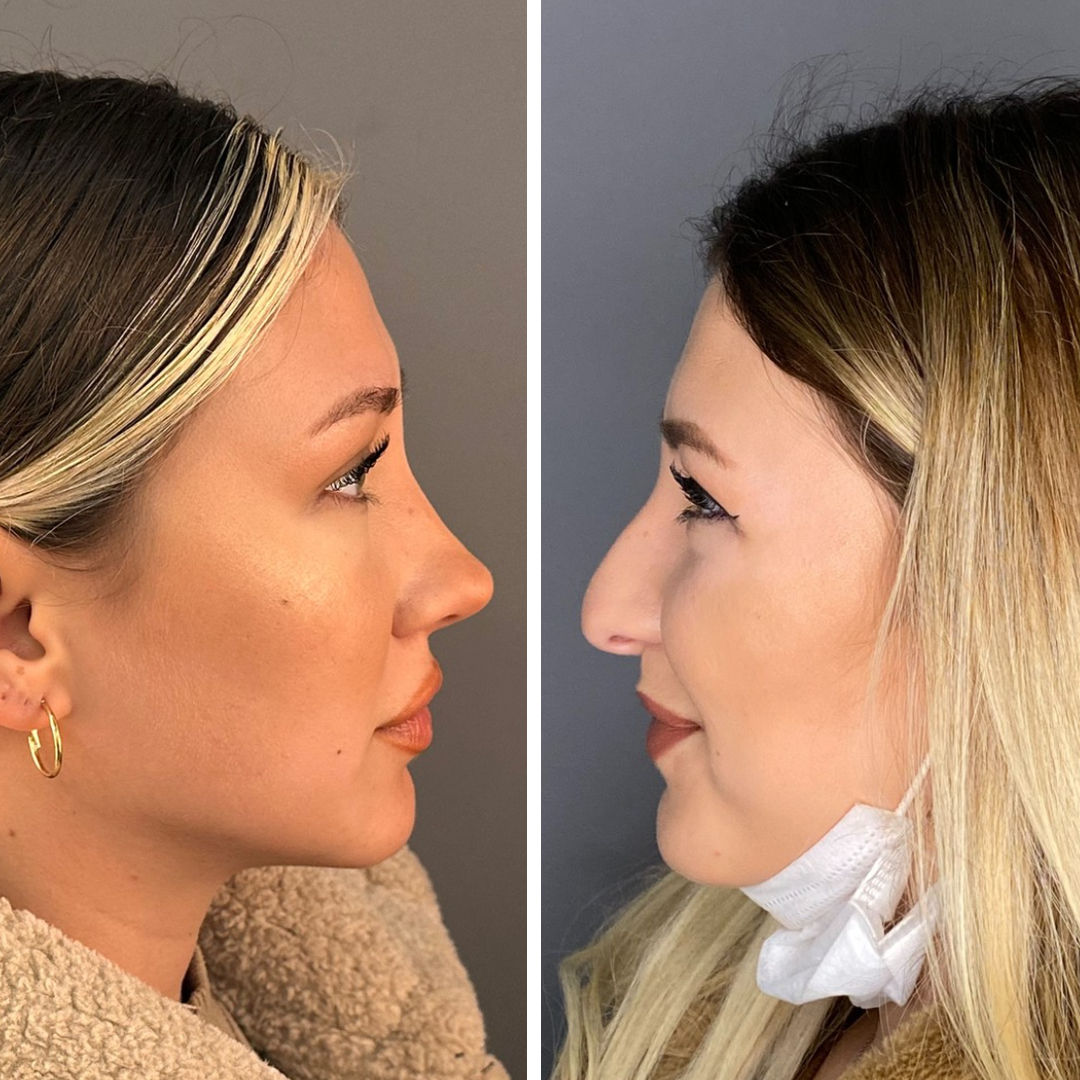 Provider-published before-and-after comparison, Mithat Topal, image 2