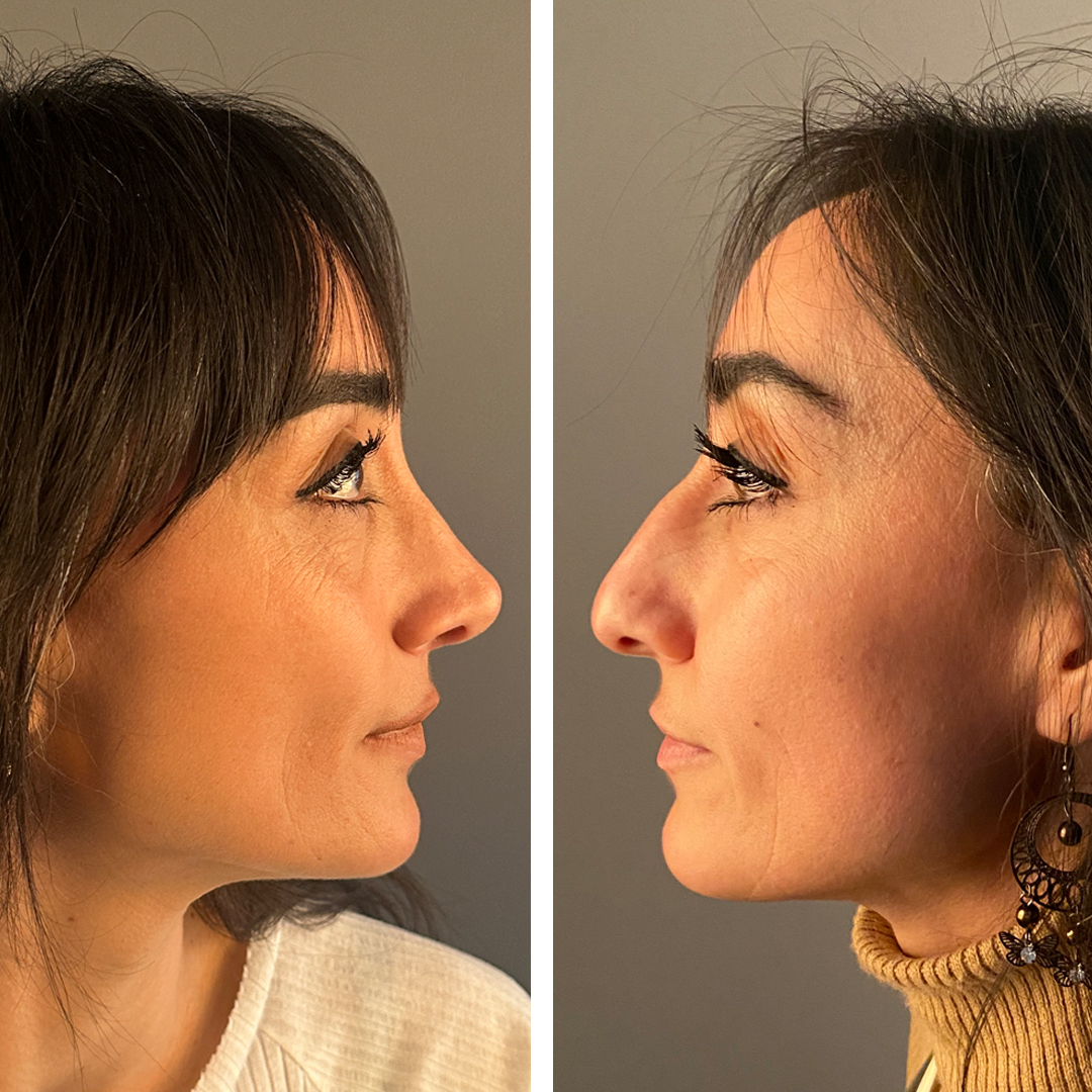 Provider-published before-and-after comparison, Mithat Topal, image 3