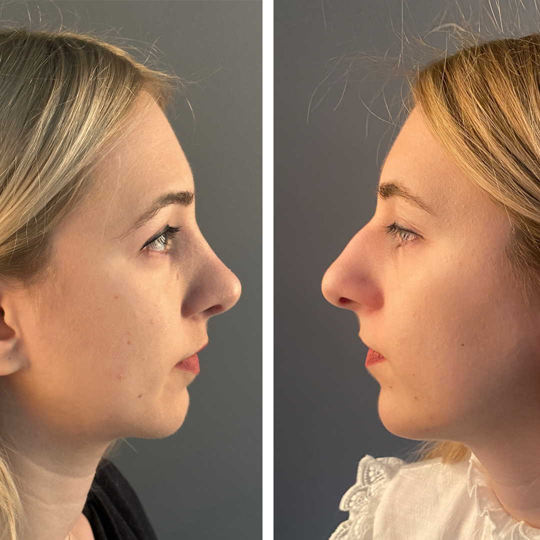 Provider-published before-and-after comparison, Mithat Topal, image 4