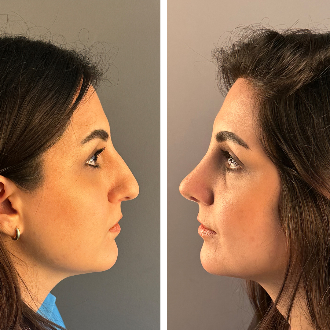 Provider-published before-and-after comparison, Mithat Topal, image 5