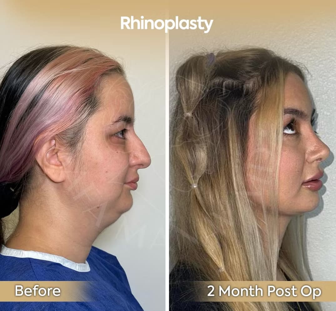 Provider-published before-and-after comparison, Safa Manav, image 3