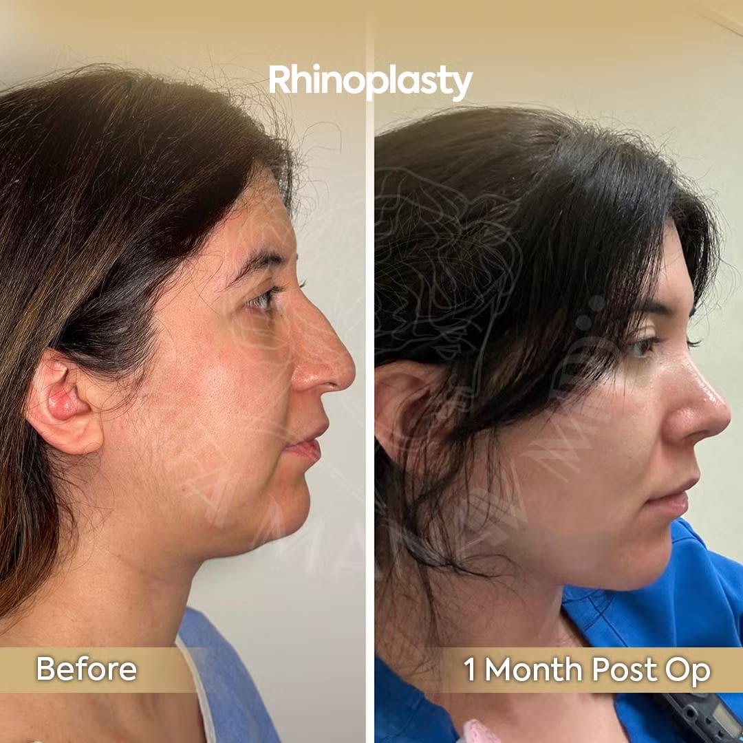 Provider-published before-and-after comparison, Safa Manav, image 4