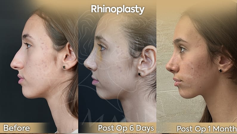 Provider-published before-and-after comparison, Safa Manav, image 5