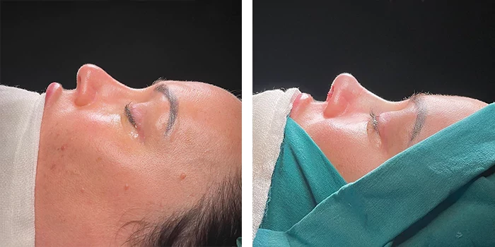 Provider-published before-and-after comparison, Sinan Eroğlu, image 3