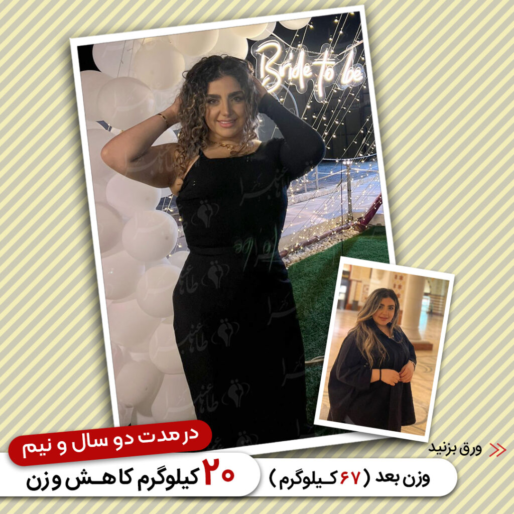 Weight loss surgery before and after case 23 published by Dr Taha Anbara