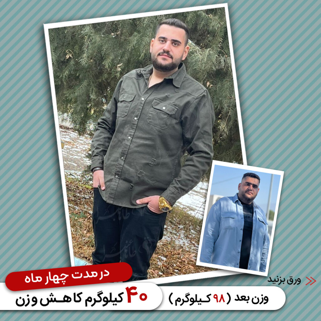 Weight loss surgery before and after case 24 published by Dr Taha Anbara