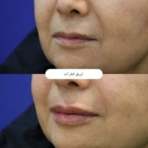 Provider-published aesthetic comparison, published example 2 from Behdis Clinic, Tehran