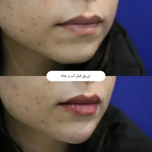 Provider-published aesthetic comparison, published example 4 from Behdis Clinic, Tehran