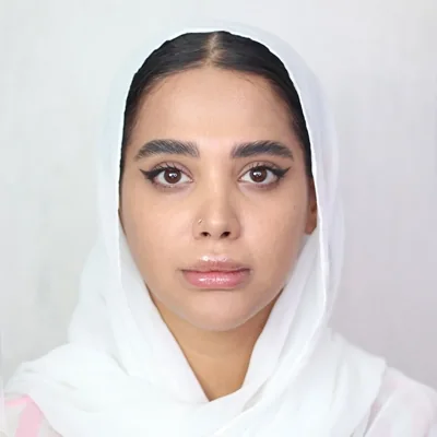 Jawline or chin filler, published example 1 from Landa Clinic, Tehran branch, Tehran