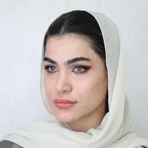 Jawline or chin filler, published example 3 from Landa Clinic, Tehran branch, Tehran