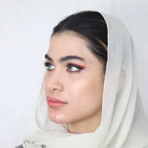 Jawline or chin filler, published example 4 from Landa Clinic, Tehran branch, Tehran