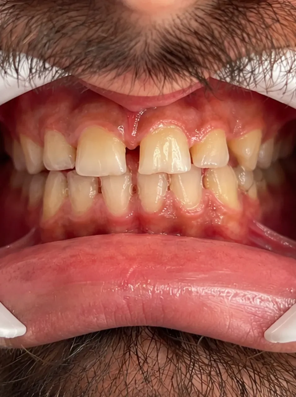 Before-treatment view from Dr. Mojgan Dasturi Clinic, example 5