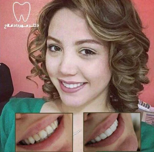Provider-published dental treatment comparison from Dr. Mehrdad Fallah Clinic, example 1