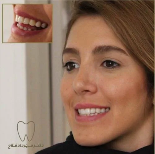 Provider-published dental treatment comparison from Dr. Mehrdad Fallah Clinic, example 3