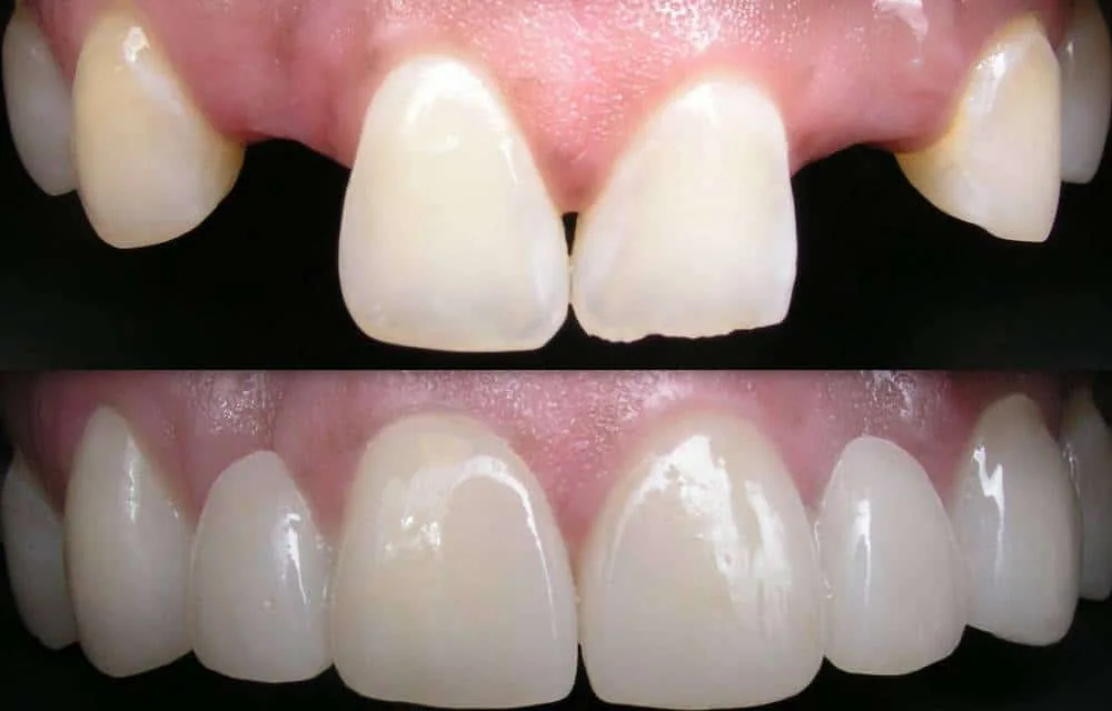 Provider-published dental treatment comparison from Dr. Farzaneh Farokhnejad Clinic, example 3