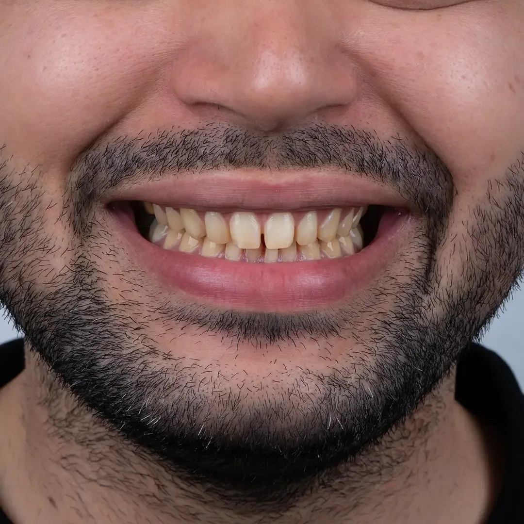 Provider-published dental treatment comparison from Dr. Shayan Ghasemnejad Clinic, example 3