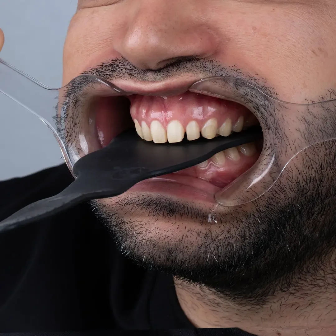 Provider-published dental treatment comparison from Dr. Shayan Ghasemnejad Clinic, example 5