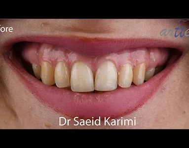 Provider-published dental treatment comparison from Dr. Saeed Karimi Clinic, example 2