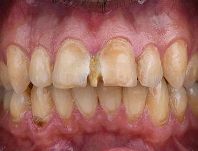 Provider-published dental treatment comparison from Dr. Saeed Karimi Clinic, example 5