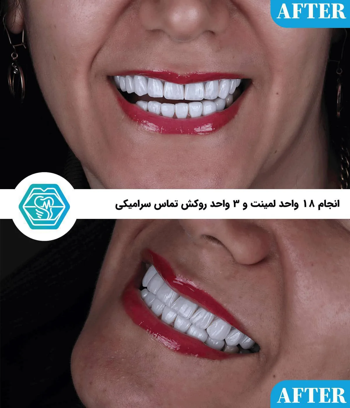 Provider-published dental treatment comparison from Negin Dental Clinic, Shiraz, example 1